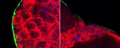 Two microscopy images of the ant brain. The image on the left shows the brain of a major worker, with high levels of the hormone-degrading enzyme in the blood-brain barrier. The image on the right shows depleted levels of the enzyme in the blood-brain barrier of minor worker ants.